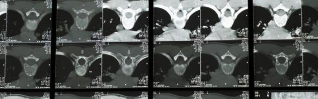 What neuroscience reveals about people who need to be alone after socializing: it’s not introversion, it’s a nervous system recovering from performance