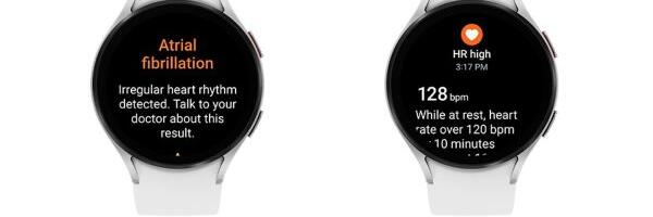 Galaxy Watch Devices Getting Irregular Heart Rhythm Notification