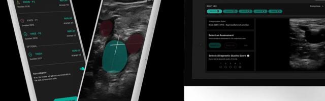 ThinkSono's AI ultrasound guidance gets £2.1M to enhance DVT diagnosis