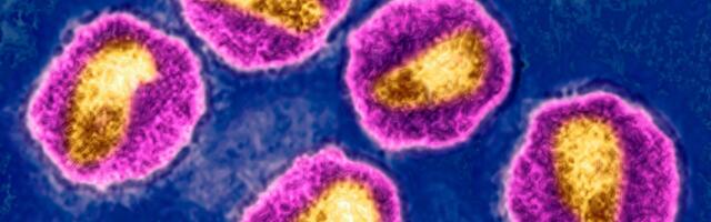 Norway Man Cured of HIV With Brother’s Stem Cells