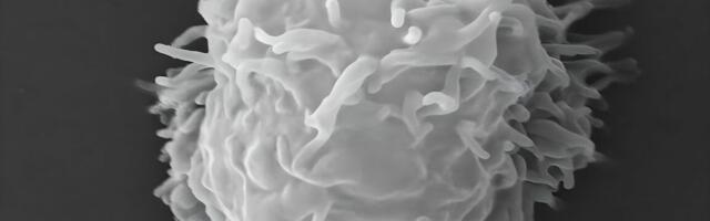 Man dies covered in necrotic lesions after amoebas eat him alive
