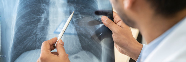 Endeavor BioMedicines raises $62 million to combat pulmonary disease