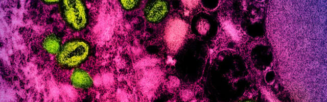Feds Suspiciously Revive the Name ‘Monkeypox’ After Dropping It in 2022