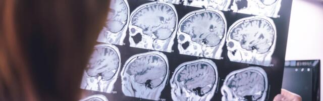 Almost half of dementia cases can be fended off, study says