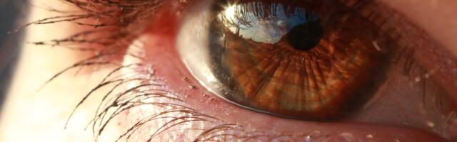 Genetic Therapy Offers Potential for Color Blindness Treatment