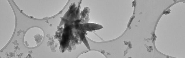 Stroke patients have high levels of microplastics in the plaque clogging their arteries, researchers find