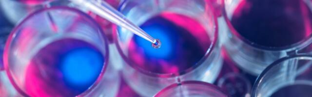 In Medical First, Woman’s Type 1 Diabetes Seemingly Cured by Stem Cells