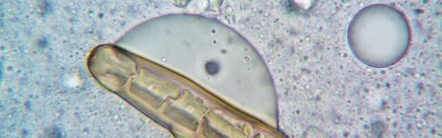 Tardigrades can survive freezing near absolute zero, extreme radiation, and the vacuum of space by drying into glass-like tuns that suspend their biology until conditions improve