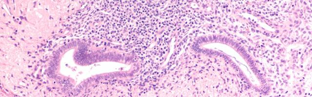 Cyclana Bio raises £5m for endometriosis drug discovery