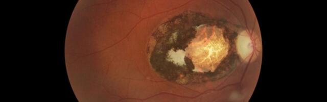 This Cat Parasite Infects Billions of People. Scientists Say We’ve Been Underestimating It