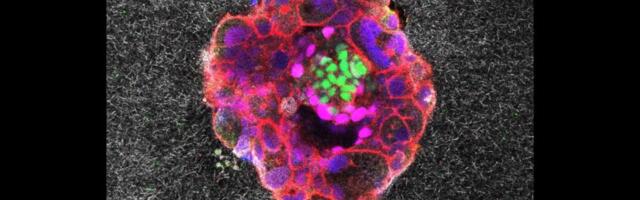 In a First, Scientists Capture Human Embryo Implantation in Real Time