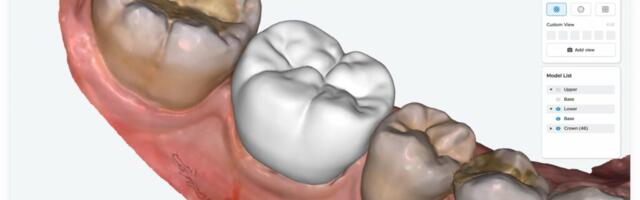 Korean startup Imagoworks launches AI-based web dental CAD 3Dme Crown