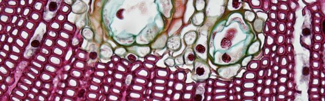 Microbiome enterotype and prenatal hormones combined act as a predictor of some illnesses