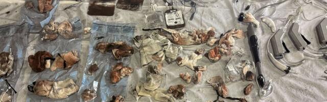 DA alleges Santa Clara County hospitals are mishandling medical waste, narcotics