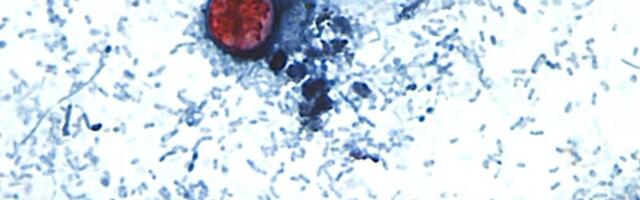 Oh Great, a Parasite That Causes Explosive Diarrhea Is Spreading Right Now