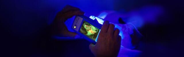 Wound care device maker MolecuLight secures $39.5 million CAD from UK-based Hayfin