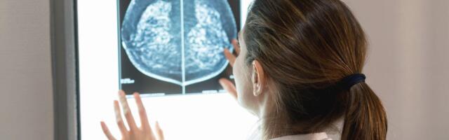 What Is Breast Density, and Why Do You Need to Know Yours?