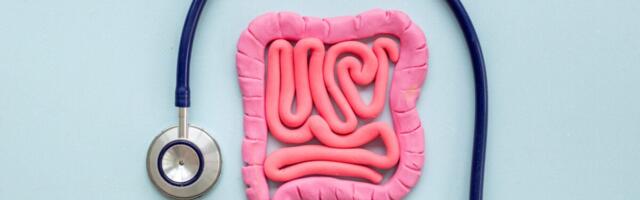 Gastrointestinal Cancers Are Surging Among Younger Americans