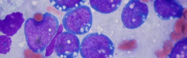 LIfT BioSciences is engineering the body’s oldest defenders to fight cancer
