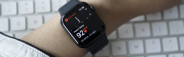 Why Do People Slap Their Apple Watches?