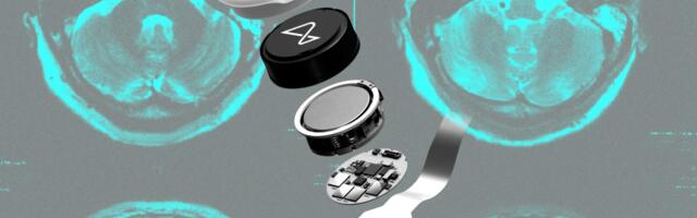 Did Neuralink make the wrong bet?