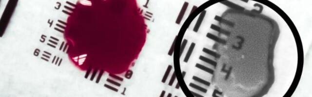 This Experimental Tech Allows Surgeons to See Through Blood