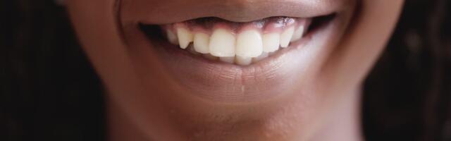 The Best Whitening Toothpaste of 2026, Recommended by Dentists