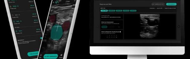 UK’s AI-powered medtech startup ThinkSono raises €2.4M, achieves EU regulatory approval