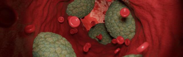 Some Heart Attacks Might Be Triggered by Germs