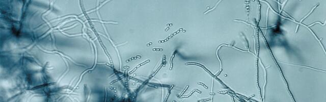 Antibiotic "megacluster" discovery provides new strategy to fight superbugs