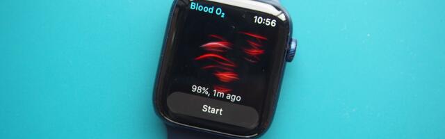 Apple says it’s survived a ‘relentless legal campaign’ against the Apple Watch — and it could mean a key health feature is returning to your wrist
