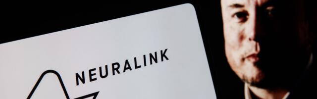 ‘Warcraft… with pure thought control’ — 100 days with Neuralink ‘feels like science fiction’ to early brain chip pioneer