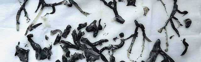 Black Gunk Found in Man’s Lungs Exposes an Even Darker Side of Wildfire Smoke