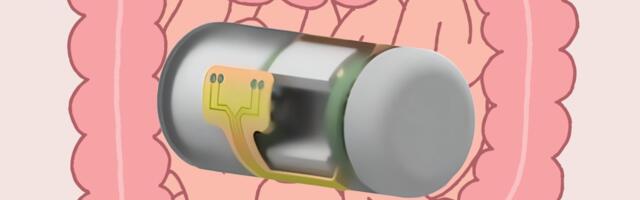 This ingestible smart capsule can wirelessly monitor gut health in real time