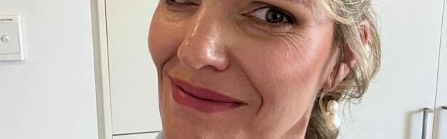 A facial injury changed my appearance — and my life. I'm strong and confident now, and I want others to feel the same.