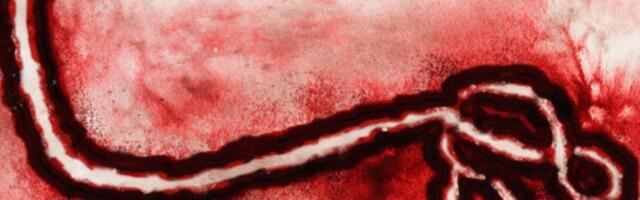 Ebola Outbreak Tops 500 Suspected Cases as American Tests Positive