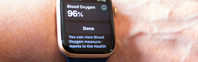 Have You Noticed Your Apple Watch Sensor Glowing Red? Here's What It's For