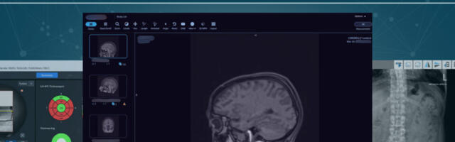 1.2 Million Healthcare Devices and Systems Found Exposed Online – Patient Records at Risk of Exposure, Latest Research from Modat