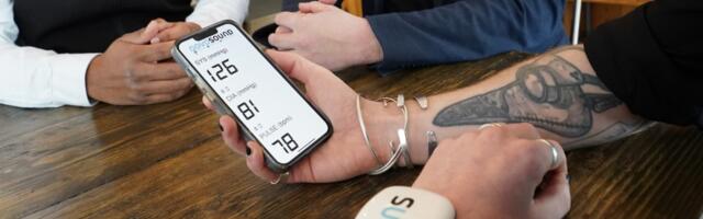 The future of real-time blood pressure sensing on smartwatches is here