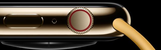 Your Apple Watch Bands May Not Work With Next Year's Model