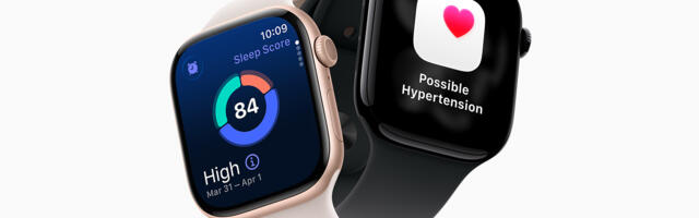 Some key Apple Watch Series 11 features are coming to older watches – will yours get the update?