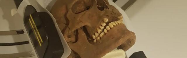 Viking Dental Health Was a Nightmare, New Skull Analysis Shows