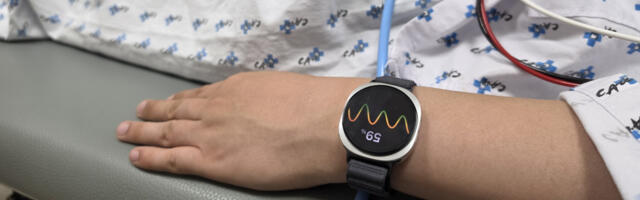 Samsung says its Galaxy Watch can predict fainting with 'high accuracy'