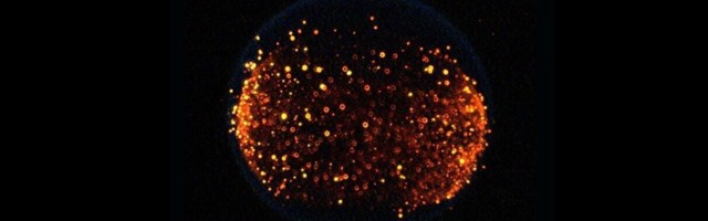 Could quantum neural networking lead to human immortality?