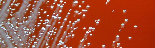 Two men fell gravely ill last year; their infections link to deaths in the ’80s