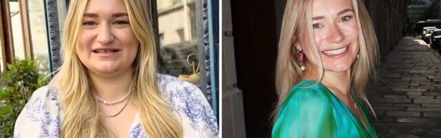 After a break-up, I paid $20K for a glow-up at 28. People on social media accuse me of using AI because I look so different.