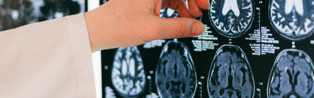 How Does the Brain Decide Mental Health for Men?