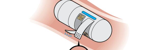 [Перевод] Умные таблетки будущего смогут точечно доставлять лекарства и брать образцы тканей