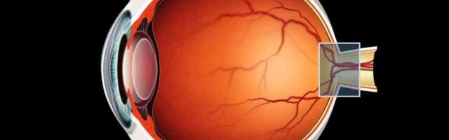 Biotech startup Perceive Bio closes $78M in Series B funding led by Johnson & Johnson to prevent the largest causes of irreversible blindness