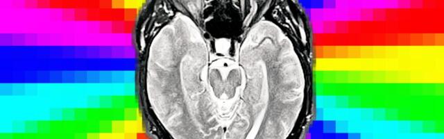 Clickbait Gives AI Models ‘Brain Rot,’ Researchers Find